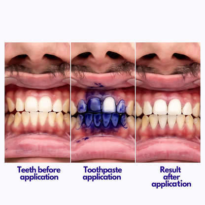 V34 Whitening Toothpaste